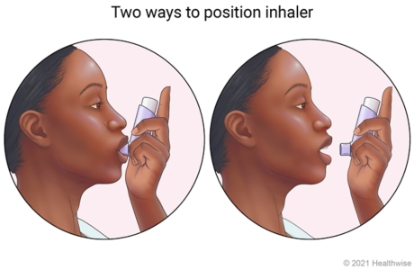 Two positions shown for using inhaler, one in mouth with lips closed around mouthpiece, and one placed 2.5 to 5 centimetres (1 to 2 inches) from open mouth. Two positions shown for using inhaler, one in mouth with lips closed around mouthpiece, and one placed 2.5 to 5 centimetres (1 to 2 inches) from open mouth.