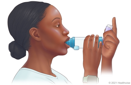 Person placing spacer mouthpiece into mouth. Person placing spacer mouthpiece into mouth.