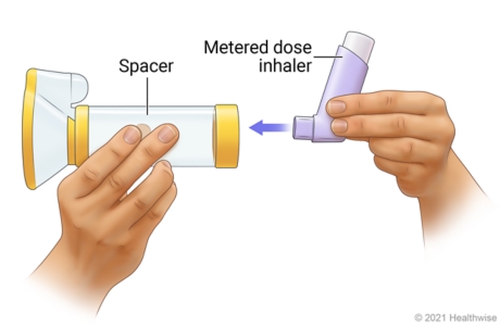 Inserting inhaler into end of mask spacer. Inserting inhaler into end of mask spacer.