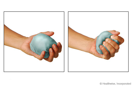Ball or sock squeeze exercise Ball or sock squeeze exercise