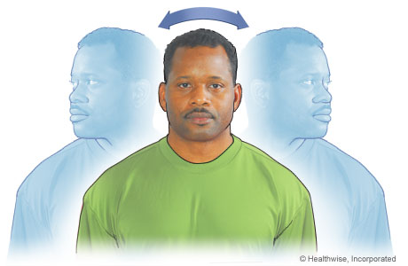 Head movement exercise side to side Head movement exercise side to side