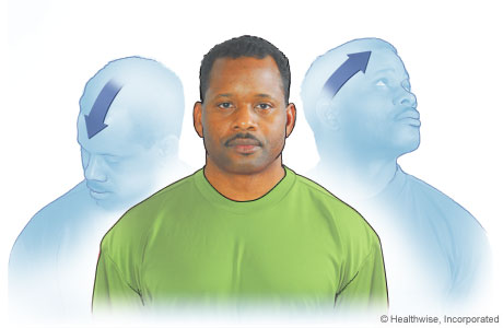 Head movement exercise diagonally up and down Head movement exercise diagonally up and down