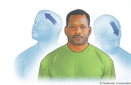 Head movement exercise diagonally up and down Head movement exercise diagonally up and down