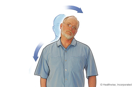 Neck stretch to ease neck aches and fatigue Neck stretch to ease neck aches and fatigue