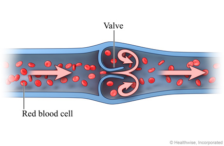 Normal venous blood flow (cross-section) Normal venous blood flow (cross-section)