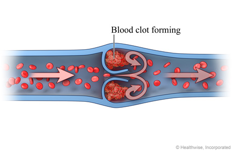 Normal venous blood flow (cross-section) Normal venous blood flow (cross-section)