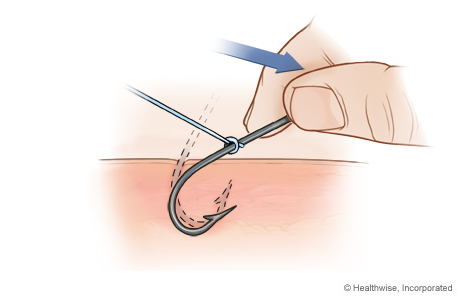 Step B: Hold hook with fingers and press down Step B: Hold hook with fingers and press down
