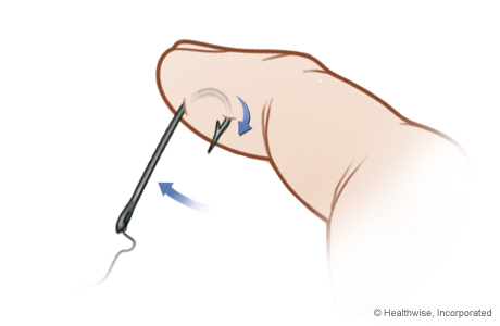 Step B: Push the hook through the skin Step B: Push the hook through the skin