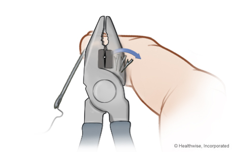 Step C: Cut off the barb Step C: Cut off the barb
