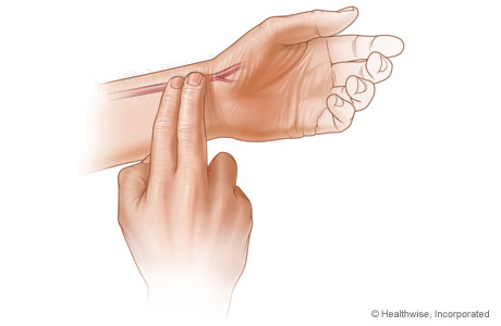 Taking pulse on thumb side of wrist using first two fingers of other hand Taking pulse on thumb side of wrist using first two fingers of other hand