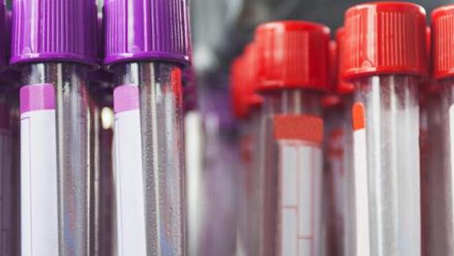 Testing order for hepatitis B, hepatitis C or HIV